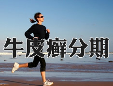 不同时期银屑病的症状介绍